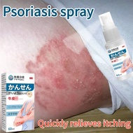 Ubat gatal Ubat kurap Psoriasis spray Ubat eczema Antibacterial Spray Quick Anti Itch Eczema Relief 