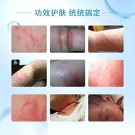 Shanghai Old Style Magpie Skin Cream Children Skin Care Anti-itch Cream Baby Baby Wet Itch Cream Mil