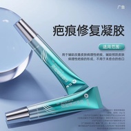 Renhe Scar Repair Scar Removal Cream Medical Repair Gel Remove Scars Burn Growth Caesarean Section B