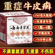 Yunnan compound Huangbai ringworm spray psoriasis ointment skin itching eczema psor云南复方黄柏祛癣喷剂牛皮癣药膏皮肤