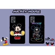 Honor 70 Honor 50 Honor X9 5g X8 5g X7 X6 10X lite X7d X9d Mickey Mouse Disney Phone Case