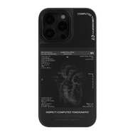 Cool Black Heart CT Scan Internal Organs X-Ray Phone Case Magnetic Absorption Original Creative Desi
