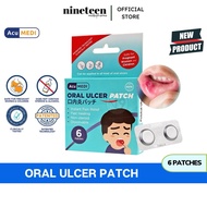 ACUMEDI Oral Ulcer Patch (6’s)