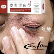 Upper Eyelid Red Swelling Long Upper Eyelid Itchy Upper Eyelid Long Small Pimples Itchy Around Eyes 