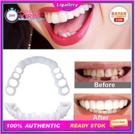 [Kualitas Terjamin] Gigi Atas Bawah Palsun Snap Instan Perfect Snap On Smile Gigi Palsu Perawatan Gigi