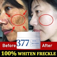 377 Whitening Cream Melasma Nicotinamide Freckle Whitening Cream Dark Whitening Cream