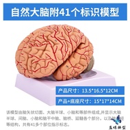 Medical Human Anatomy Brain Teaching Model