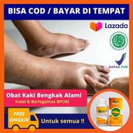 Obat Kaki Bengkak Akibat Luka Jatuh Penyakit Diabetes Ginjal Bocor Jantung Dll - Obat Luka Jatuh Dar