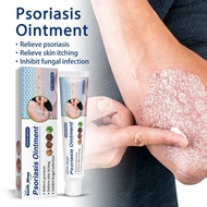 Sonlh Mnon Skin Itching Cream External Use Apply Dry Skin Itchy Skin Itchy Skin Itchy Skin Care Crea