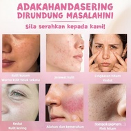 【4 pek】7Lume 9 in 1 White Tomato Powder Minuman Mix royal berry Kencang & Cerah Kulit acai berry pow