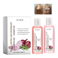2PCS Onion Biotin and Rosemary Shampoo Set,Onion Biotin and Rosemary Shampoo, Onion and Biotin Shamp