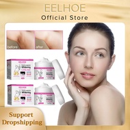 EELHOE Body Whitening Cream Remove Dark Spots Lighten Melanin Underarm Leg Knee Elbow Bleaching Private Parts Brightening Cream
