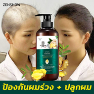 ของแท้ 100% ZENSHOW แชมพูเร่งผมยาว ยาสระผมแก้ร่วง Hair loss shampoo ยับยั้งรังแค แชมพูลดผมร่วง แชมพูแก้ผมร่วง ผมบาง ปลูกผม เร่งผมเกิดใหม่ ผมยาวไว แชมพูสมุนไพร ยาสระผมแก้ผมร่วงสูตรแก้ปัญหาผมร่วง แชมพูขิงเพียว