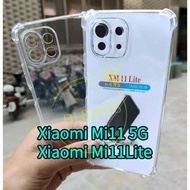 Mi11 ✨พร้อมส่งในไทย✨เคสใสกันกระแทกคลุมกล้อง For Xiaomi Mi11 5G  Xiaomi Mi11  XiaomiMi11 / Mi11Lite /