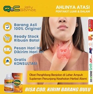 Obat Gondok Tiroid  Kelenjar Tiroid - Obat Tumor Rahang Kelenjar