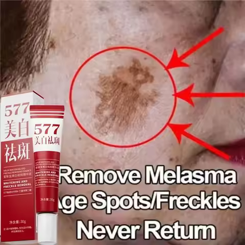 577 Whitening Freckles Face Cream Remove Melasma Dark Spots Corrector Lighten Melanin Pigmentation B