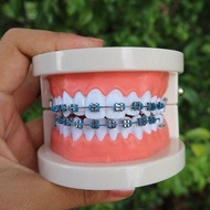 [Ready stock] Braces click murah sepasang | Braces Viral fashion Murah Fast Shipping