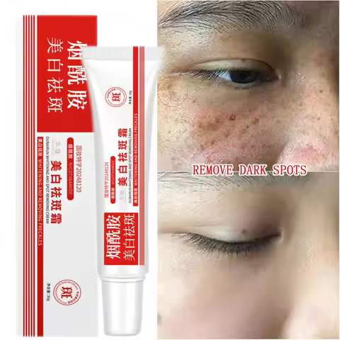 Whitening Freckle Cream Remove Dark Spots Anti Freckle Face Creams Niacinamide Fade Pigmentation Mel