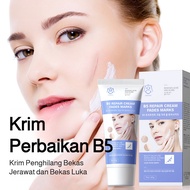 🏅【®️OOUWA】Postoperative acne scar cream, acne scar lightening and repair cream, scar repair cream, p