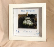 2020012 Pigura / frame 3d USG Baby Photo Frame