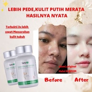 Pemutih Tubuh Vitaline Softgel Tiens Vitagel Kapsul Pemutih Badan