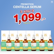 ส่งฟรี 1 แถม 1 AGLAM ACNE CLEAR SERUM [ แอคเน่ เคลียร์ เซรั่ม ]เซรั่มสำหรับคนเป็นสิว