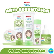 Pigeon TEENS Teen Skincare Package for Skin, Contents of 5