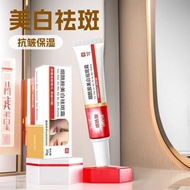 Freckle Removal Cream Transparent Whitening Renewing Niacinamide Freckle Blemish Blemish Blemish Ble