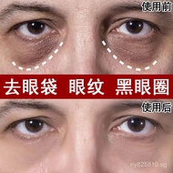 Wholesale Anti-Wrinkle Dark Circles Eye Cream Firming Fat Granules Remove Eye Bags Fade Eye Cream Fi
