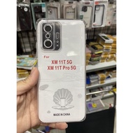 Xiaomi Mi 11T 5G / Mi 11T pro 5G Case Is Flexible And Transparent To Protect The camera