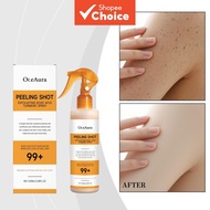 Kojic Acid & Turmeric Body Spray 100ml, Exfoliating Formula with Salicylic Acid & Retinol for Pore P