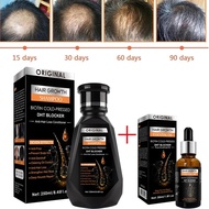 【Qahwed】 hair growth essential biotin cold-pressed DHT blocker and hair growth shampoo anti-hair los