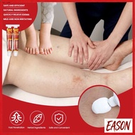 Hot Style LEG EDEMA CREAM krim edema kaki bengkak betis peha buang angin kecutkan bengkak edema mela