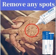 Women Fade Melasma Freckle Brightening Cream Lighten Melanin Dark Spot Pigment Stain Corrector Emuls