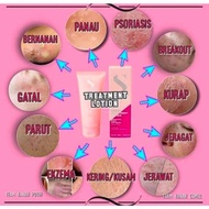Treatment Lotion Susu Unta 💯 Ori HQ | EKZEMA | PSORIASIS | GATAL² | RUAM |