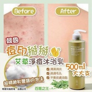 韓國🇰🇷痘印掰掰艾草淨痘沐浴乳