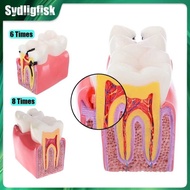 8/6Times Caries Teeth Comparative Study Denture Tooth Dental Anatomy Teaching Studying Demonstratio