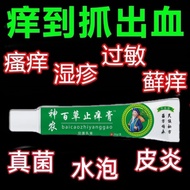 Itchy Hands Feet Dry Itchy Dermatititis Eczema Sweat Herbal Antibacterial Cream Itch Relief