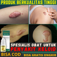 Obat Penghilang keloid Daging Jadi/Tumbuh Menonjol Tahunan Skin Tag Kutil Kelamin Bekas Operasi Jahi