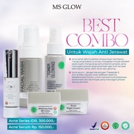 Ms glow ACNE SKINCARE combo