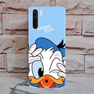 Hardcase OPPO A91/ RENO 3 - Casing hp - Hardcase Case OPPO A91/ RENO 3- Casing hp - Hardcase - Case 