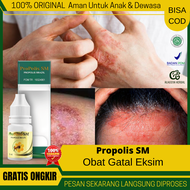 Obat Gatal Eksim Kering Menahun Propolis SM 100% BERKHASIAT - Salep Pengering luka Basah/Kering - Ob