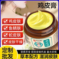 Chicken Skin Cream Chicken Skin Snake Skin Fish Scale Skin Chicken Skin Cream Remove Chicken Skin