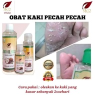 NEW Sr12 Vico Oil Minyak Kelapa Asli Atasi Kaki Pecah-Pecah Herbal