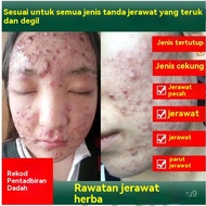 acne treatment pimple cream praventac acne pair cream ubat jerawat Krim Rawatan Jerawat acne aid jer
