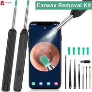 Ear Wax Removal Tool with Camera 1296P HD Otoscope Ear Cleaner Wireless Ear Otoscope Earwax Removal Kit Compatible with iOS Android SHOPSKC2571