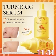 MAY BIOAQUA Turmeric Serum Anti-Oxidation Soothing Inhibition Acne Skin Hydrating Moisturizing Rejuv