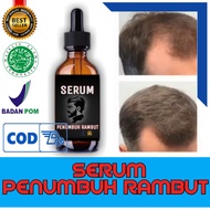 Penumbuh Rambut / Penumbuh rambut botak pria / Serum penumbuh rambut / Penumbuh rambut / rambut lemb
