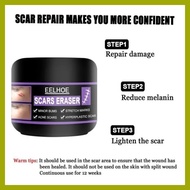 ➝ ➯ ▐ EELHOE Original Scar Repair Cream for old scar stretch mark remover acne scar remover Aliver