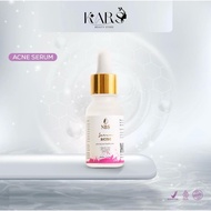 NBS Acne serum 15ml